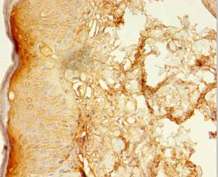 LSMEM2 Polyclonal Antibody