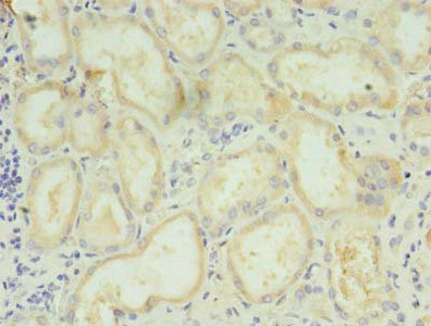LYPLAL1 Polyclonal Antibody