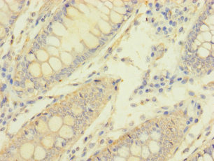 MACROD1 Polyclonal Antibody