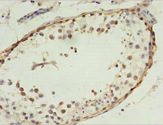 MAGEA4 Polyclonal Antibody