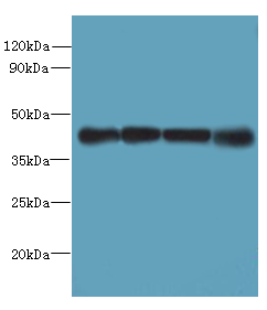 MAGEB18 Polyclonal Antibody