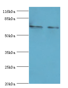 MAGEC3 Polyclonal Antibody