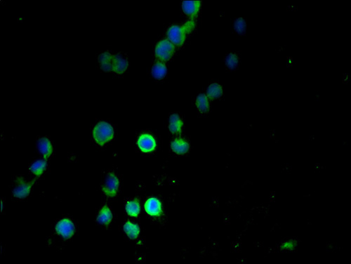 MANBAL Polyclonal Antibody