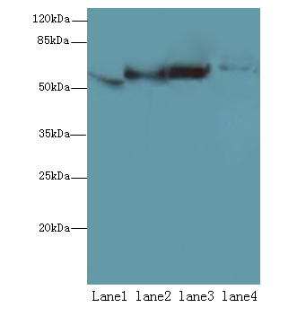 MAOA Polyclonal Antibody