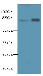 MASP1 Polyclonal Antibody