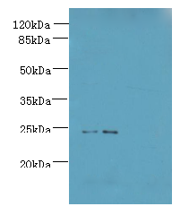 MED18 Polyclonal Antibody