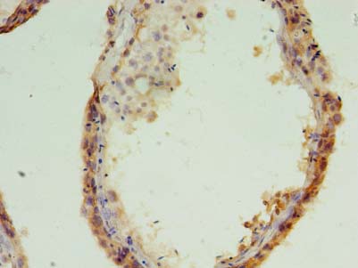 MED28 Polyclonal Antibody