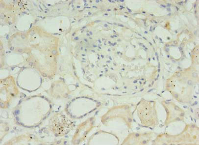 MED30 Polyclonal Antibody