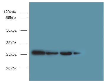 MED7 Polyclonal Antibody