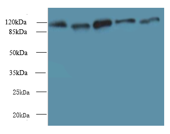 MORC2 Polyclonal Antibody