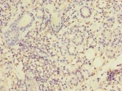 MPPED1 Polyclonal Antibody