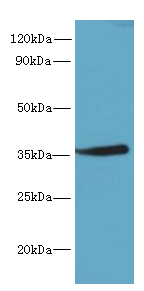 MPPED2 Polyclonal Antibody