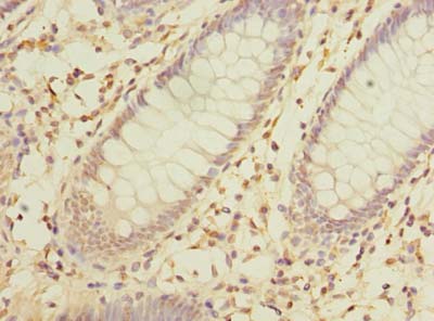 MRPL16 Polyclonal Antibody
