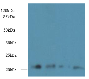 MRPL18 Polyclonal Antibody