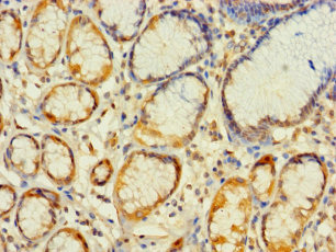 MRPL2 Polyclonal Antibody