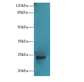MRPL22 Polyclonal Antibody