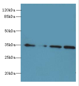 MRPL3 Polyclonal Antibody