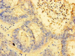 MRPL38 Polyclonal Antibody