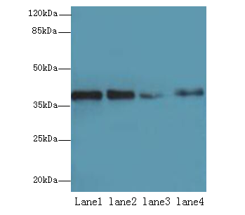MRPL44 Polyclonal Antibody