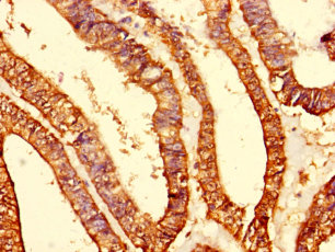 MRPS10 Polyclonal Antibody