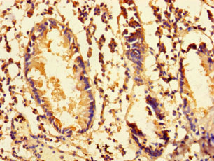 MRPS28 Polyclonal Antibody