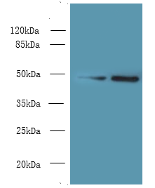 MRPS5 Polyclonal Antibody