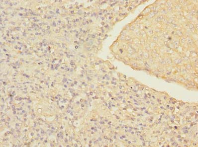 MRRF Polyclonal Antibody