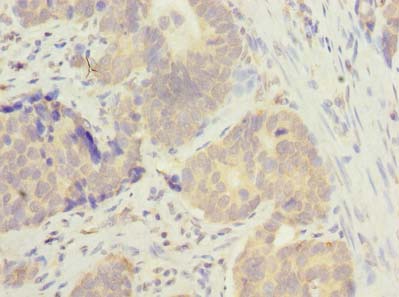 MSTO1 Polyclonal Antibody