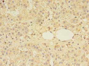 Immunohistochemistry of paraffin-embedded human adrenal gland tissue using MTR Polyclonal Antibody at dilution 1:100