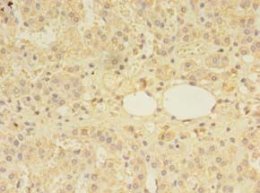 MTR Polyclonal Antibody