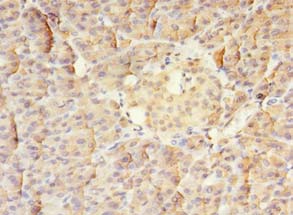 Immunohistochemistry of paraffin-embedded Human pancreatic tissue using MTR Polyclonal Antibody at dilution 1:100