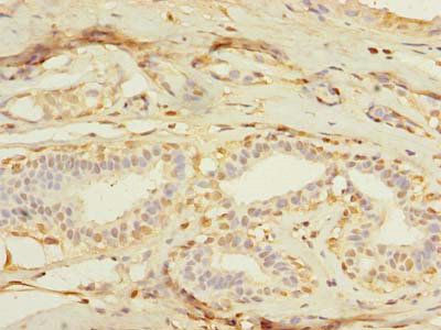 MXD3 Polyclonal Antibody