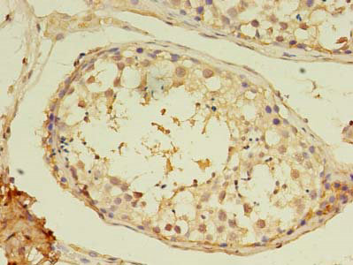 MYH7B Polyclonal Antibody