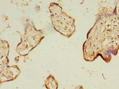 NARS2 Polyclonal Antibody