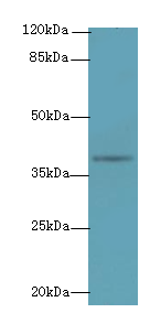 NAT2 Polyclonal Antibody