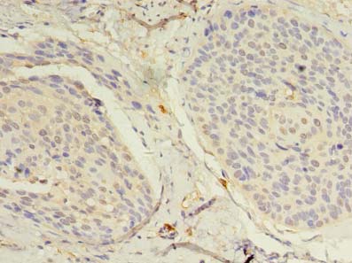 NAT8 Polyclonal Antibody