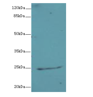 NEGR1 Polyclonal Antibody