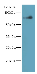NEK11 Polyclonal Antibody