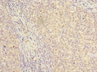 NKIRAS2 Polyclonal Antibody