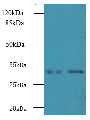 NMRAL1 Polyclonal Antibody