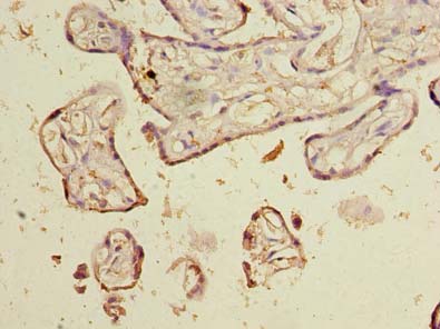 NOL6 Polyclonal Antibody