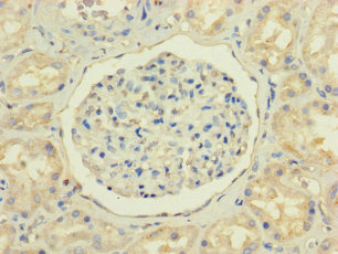 NPC2 Polyclonal Antibody