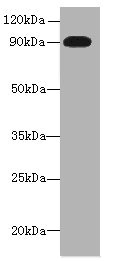 Western blot<br />All lanes: NRG2 Polyclonal Antibody at 16ug/ml+ U251 whole cell lysate<br />Goat polyclonal to rabbit at 1/10000 dilution<br />Predicted band size: 92, 91, 93, 47, 46, 68, 71 kDa<br />Observed band size: 92 kDa<br />