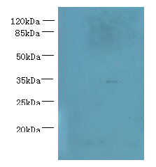 NUBPL Polyclonal Antibody