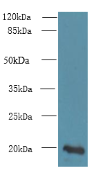 NUDT11 Polyclonal Antibody