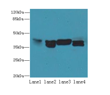 NUDT9 Polyclonal Antibody