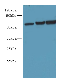 OSBPL2 Polyclonal Antibody