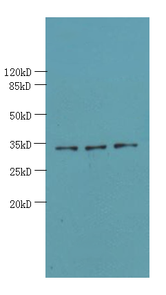 OTUD6B Polyclonal Antibody