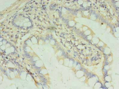 PAFAH1B2 Polyclonal Antibody