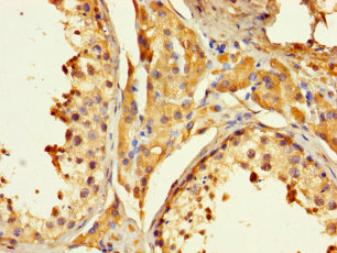 PAGE1 Polyclonal Antibody